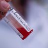‘New way’ of using standard blood test ‘could help spot cancer sooner’